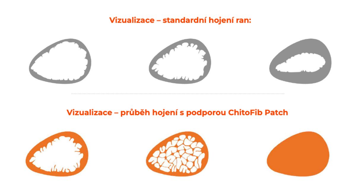 hojeni-ran-chitofib